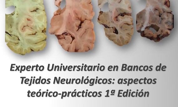 El BT- CIEN participa en la I edición del Curso de Experto en Bancos de Tejidos Neurológicos