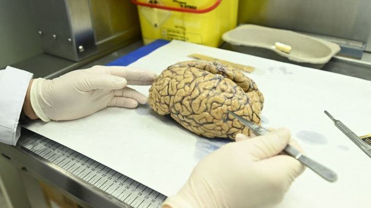 Un almacén de cerebros en Madrid: su donación, clave para la investigación médica